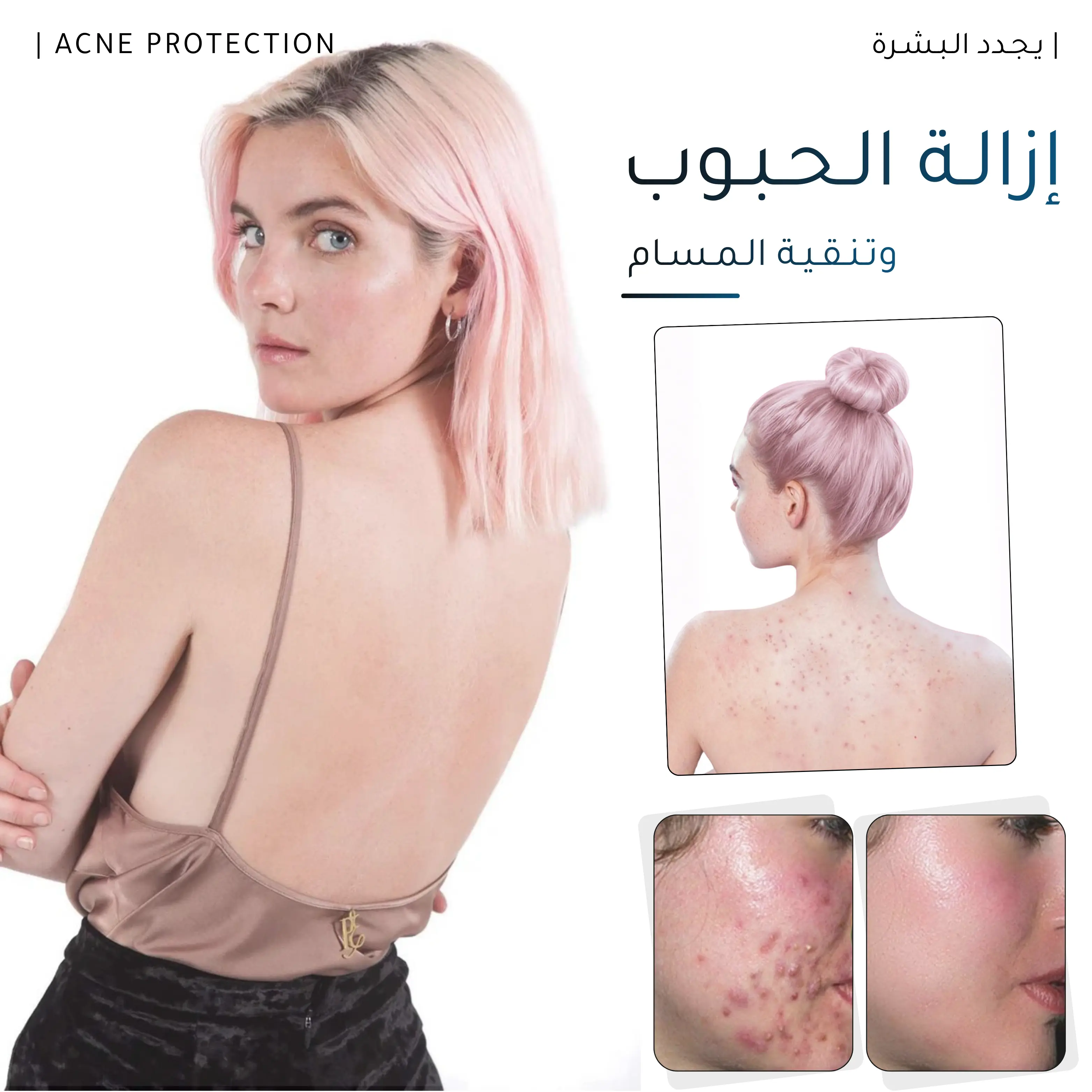 كـريـم إزالـة الـحـبـوب