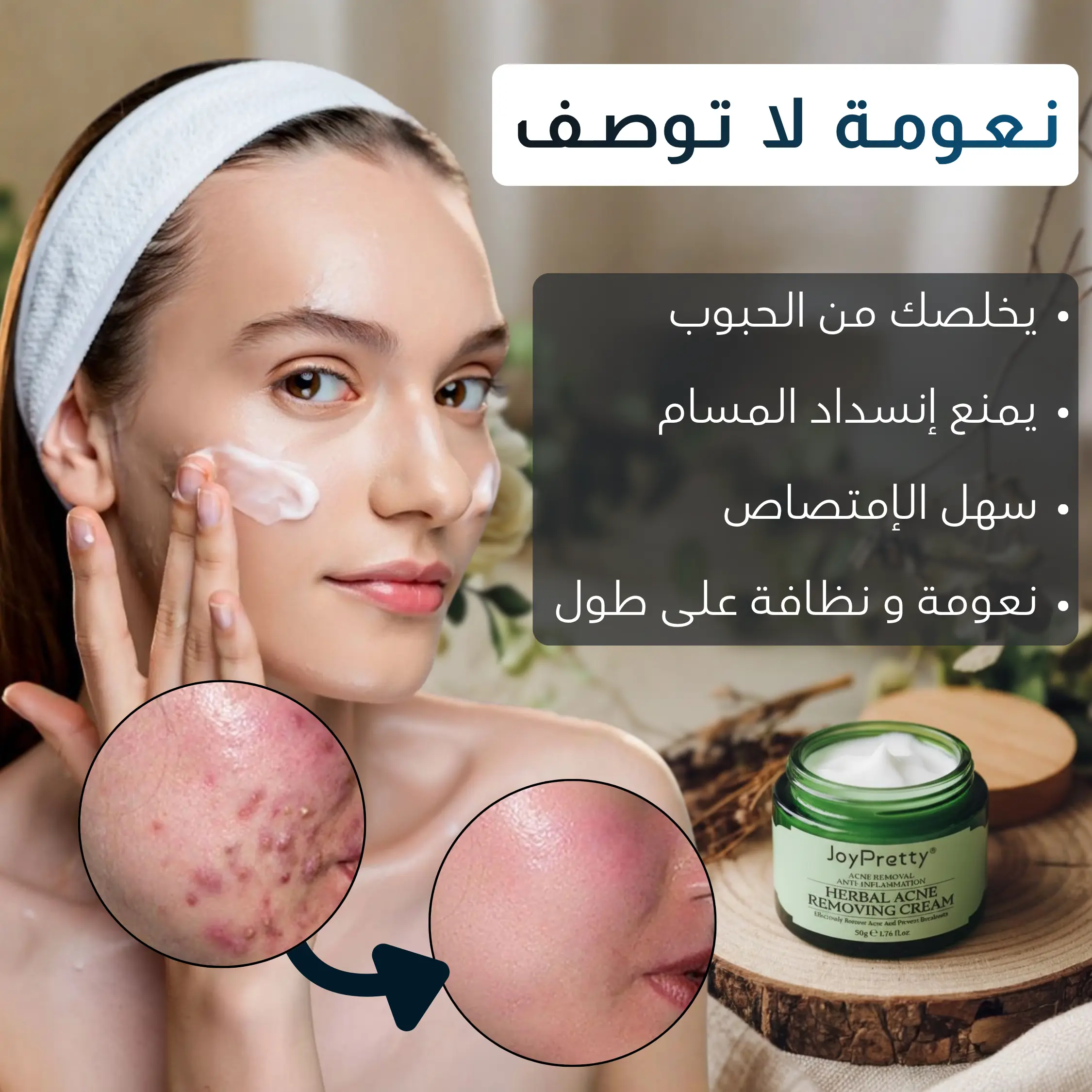 كـريـم إزالـة الـحـبـوب