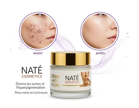 كريم الكلف والتصبغات