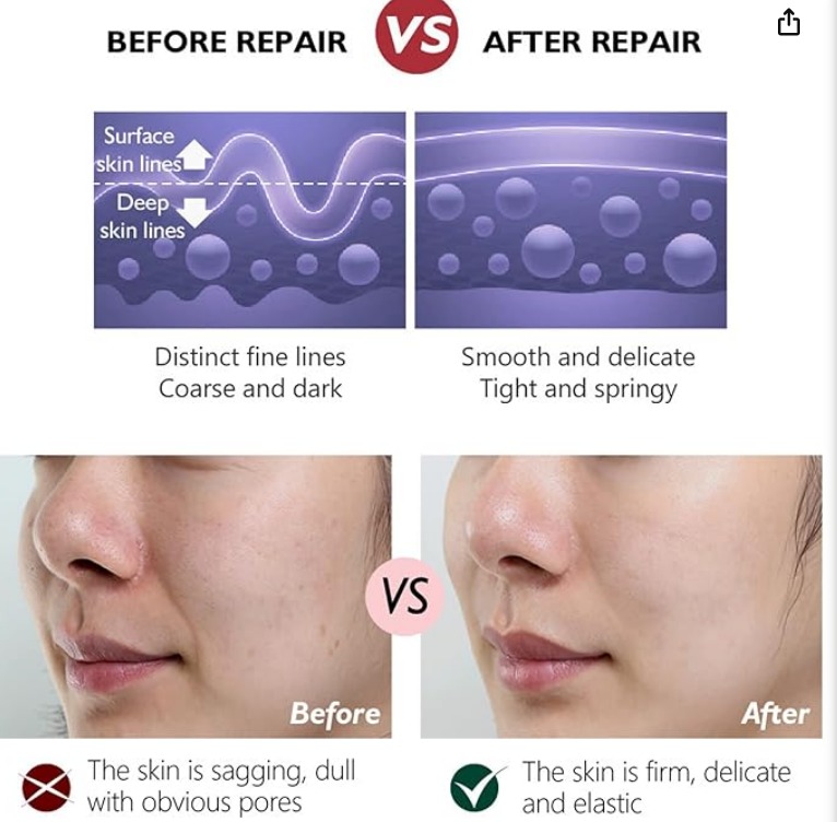 • Retinol cream (Anti-Aging)