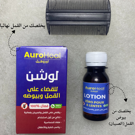 مع أوروهيل تخلصي من القمل نهائيا من أول إستعمال