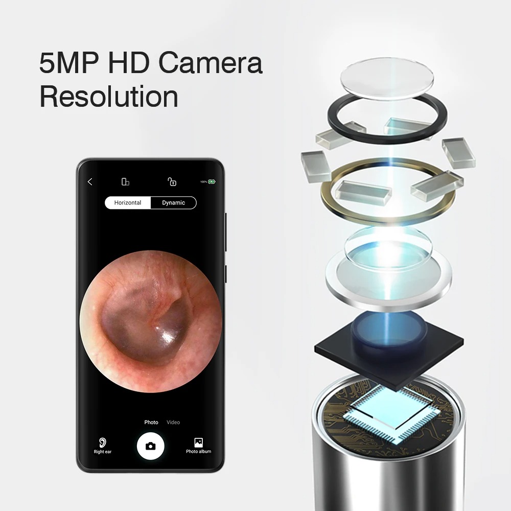 🧼 EarVision N3™ – Le nettoyage d’oreilles intelligent à la pointe de la technologie !