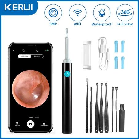 🧼 EarVision N3™ – Le nettoyage d’oreilles intelligent à la pointe de la technologie !