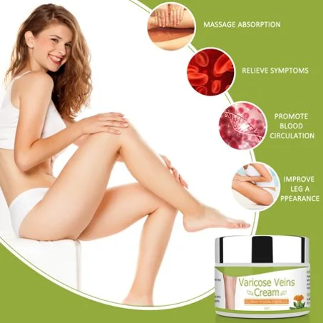 Varicose Veins Cream  مرهم لعلاج الدوالي