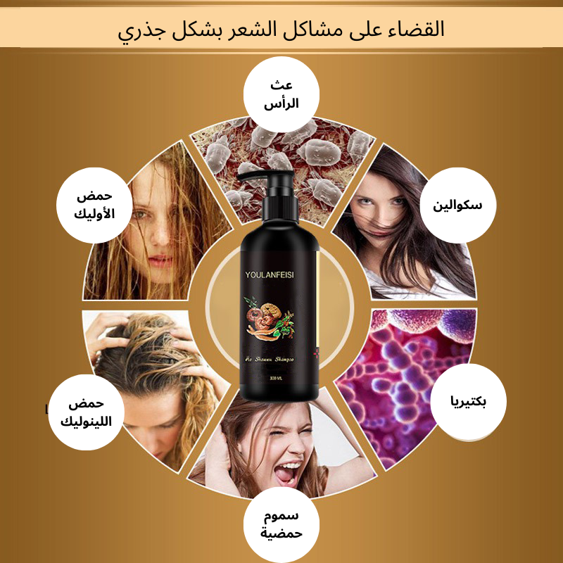 شامبو الشعر الأسود