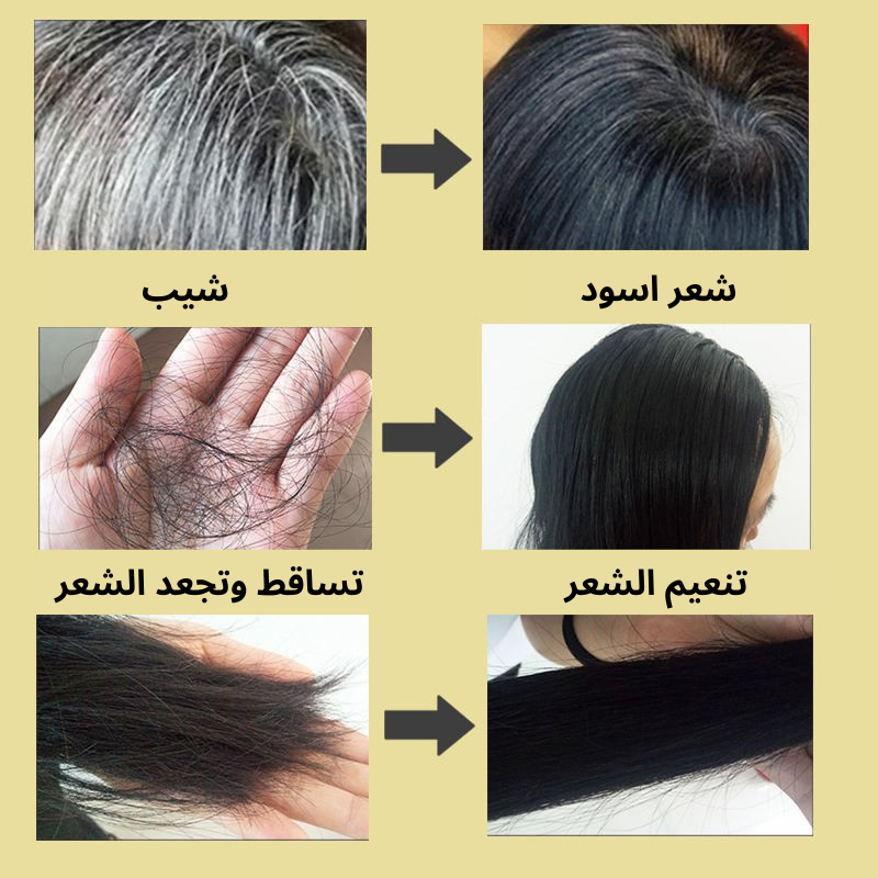 شامبو الشعر الأسود
