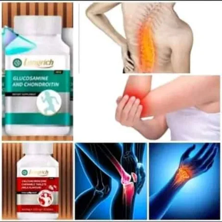 arthro supReviver