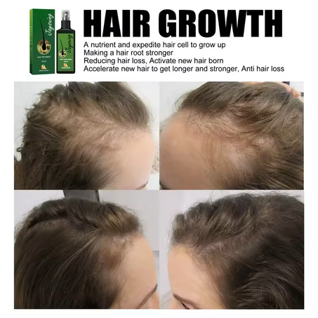 Hair Growth Serum