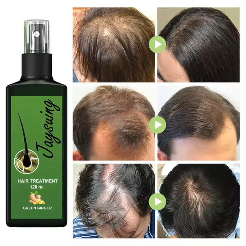 Hair Growth Serum