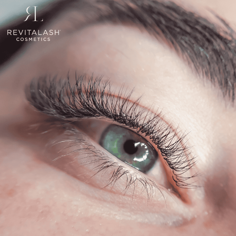 سيروم ريفيتالاش