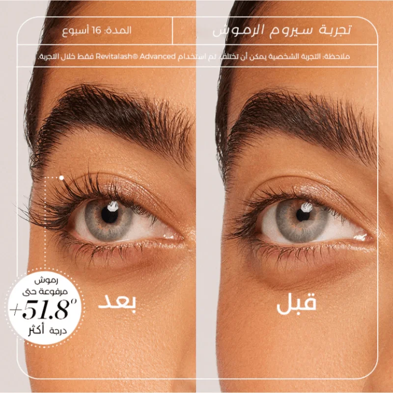 سيروم ريفيتالاش *3 حبات