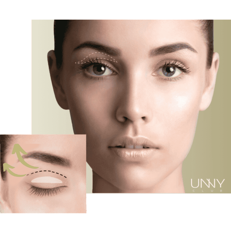 لاصقات الجفون أوني كلوب