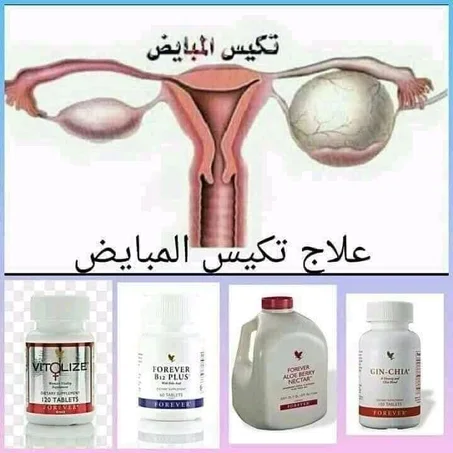 علاج تكيس المبايض من فوريفر