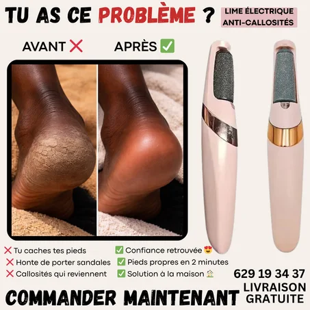 LIME ÉLECTRIQUE – PIEDS DOUX EN 2 MINUTES 👣✨🔥 +500 clients satisfaits en Guinée”