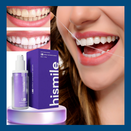 جل تبييض الأسنان