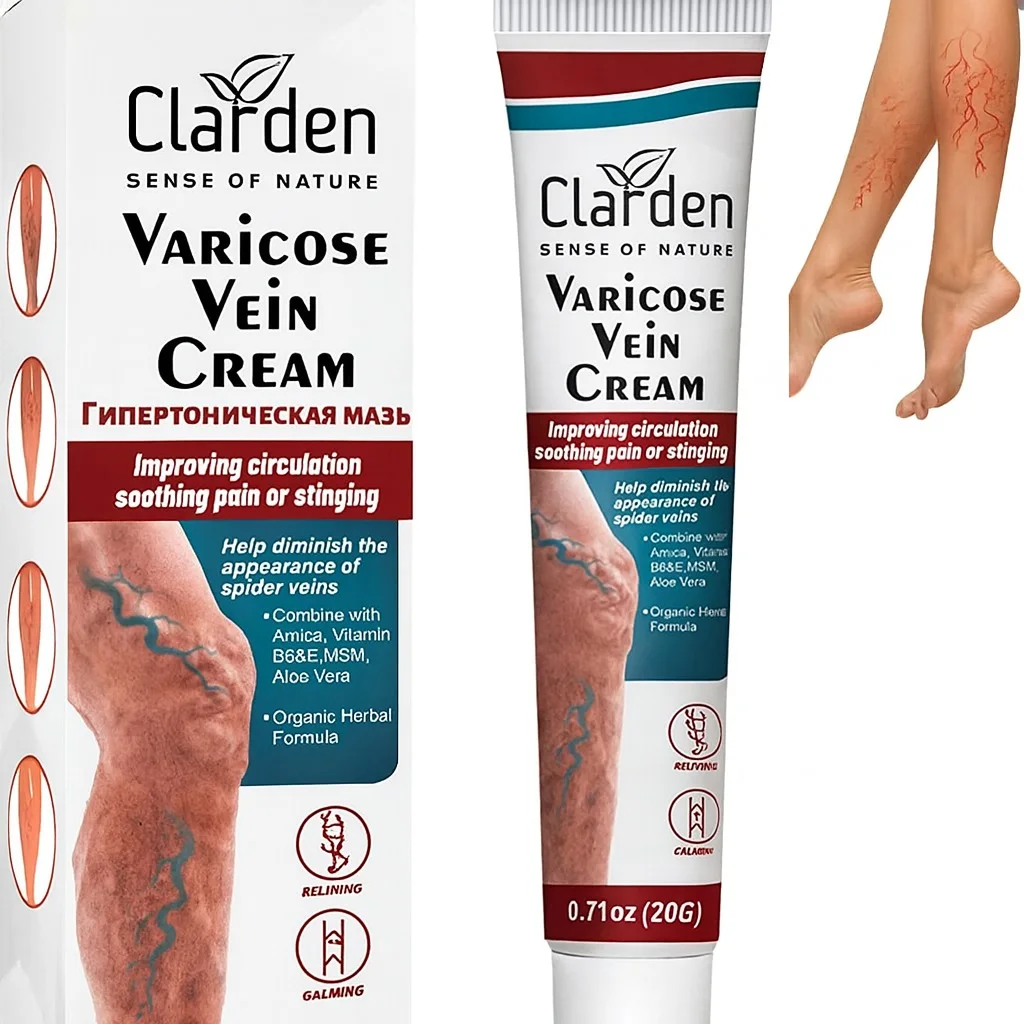 كريم الدوالي - Cream Varicose Veins
