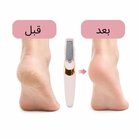 مقشر القدمين الكهربائي
