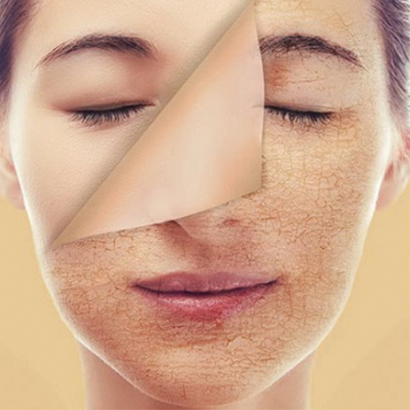 مقشرات الجسم