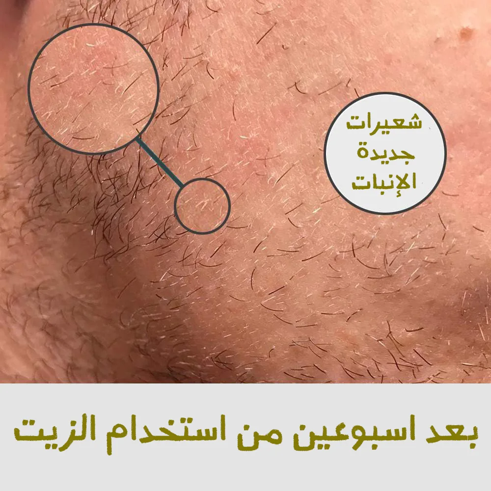 (سر اللحية الجذابة  (ماكينة تحديد وتنعيم الشعر الصغيرة + زيت التحفيز هدية