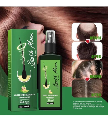 بخاخ الزنجبيل سبراي نيو هير لوشن طبيعي لفروة الرأس لنمو الشعر