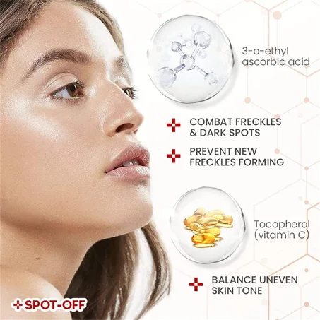 كريم إزالة التصبغات للوجه، كريم إزالة النمش، كريم تصحيح البقع الداكنة للوجه والجسم، يزيل الكلف والتجاعيد والتصبغات