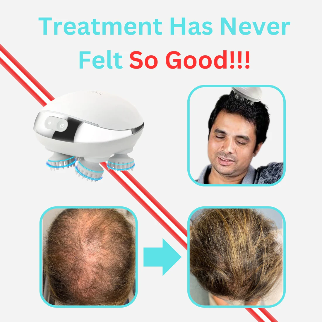 جهاز مساج الرأس وفروة الشعر – Head & Scalp Massage