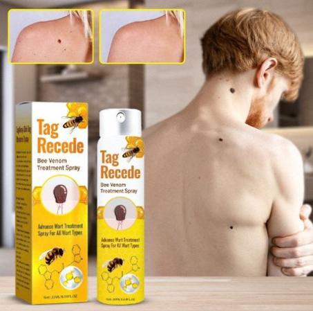 Tag Recede بخاخ التآليل بسم النحل