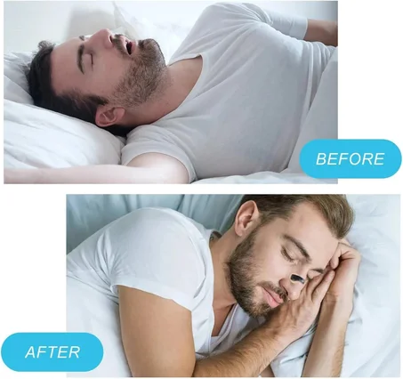 شرائط أنف مغناطيسية لمنع الشخير وتحسين النوم الطبية