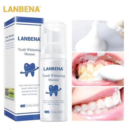 Mousse de blanchiment des dents LANBENA
