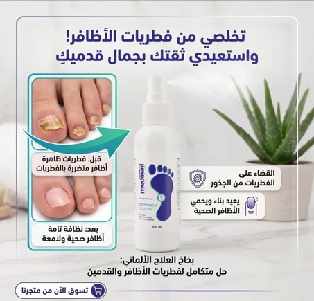 Medinail Spray: الحل الألماني النهائي لفطريات الأظافر - استعيدي جمال قدميك