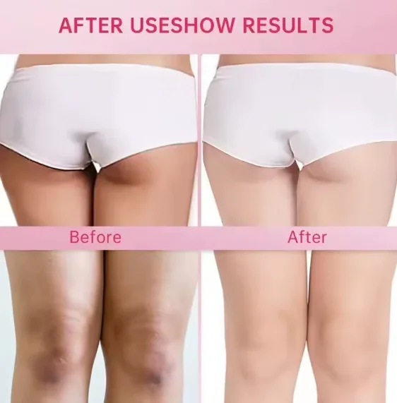 لوشن التبييض الفوري وإزالة البقع الداكنة