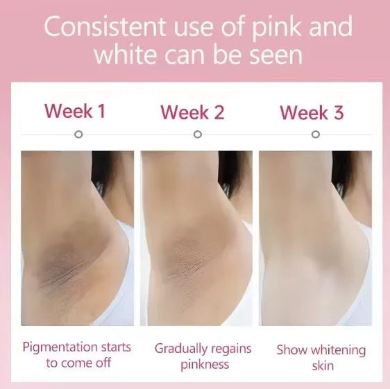 لوشن التبييض الفوري وإزالة البقع الداكنة