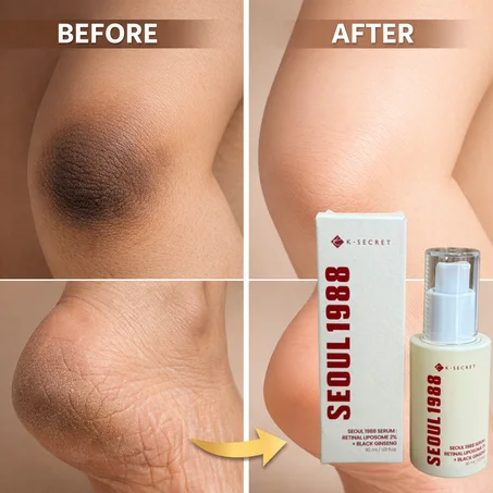 سيروم سيول 1988 لإشراقة البشرة 'تجميل'