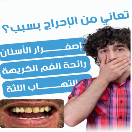 قلم تبييض الأسنان  - ابتسامة أكثر إشراقًا في ثوانٍ! ✨🦷 يدووم فترة طويلة