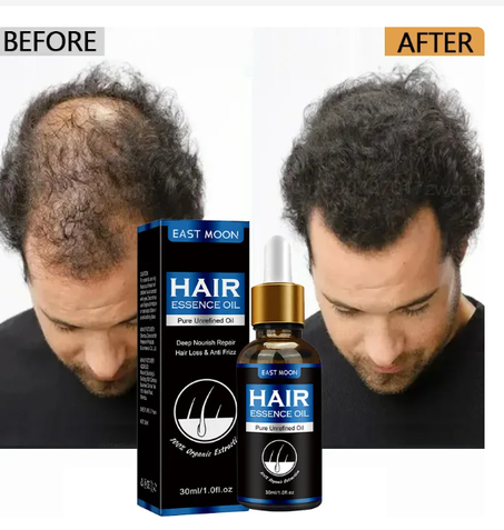 ايسنس هير الاصلي سيروم يحفز نمو الشعر واللحية يرطب الشعر ويعطيه لمعان و حيوية
