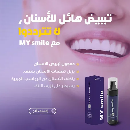 معجون تبييض الأسنان