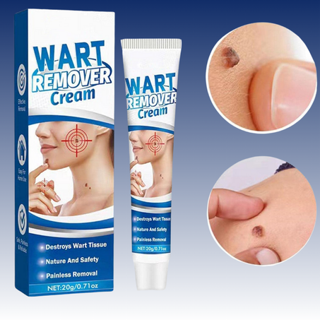 الكريم السحري لإزالة الثآليل