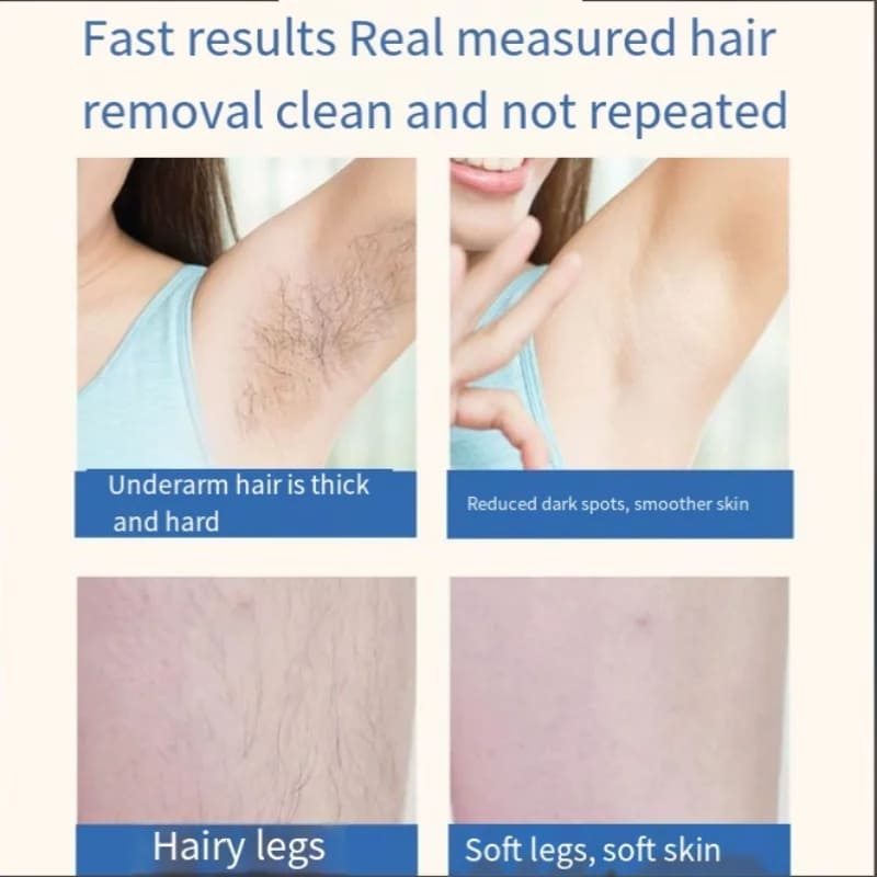 IPL Laser Hair Removal Device