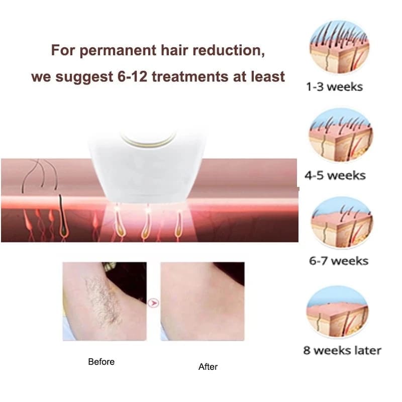 جهاز إزالة الشعر بالليزر IPL – تكنولوجيا احترافية لبشرة ناعمة في كل الأوقات