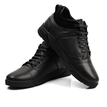 حداء من الجلد