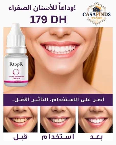 مبيض الأسنان