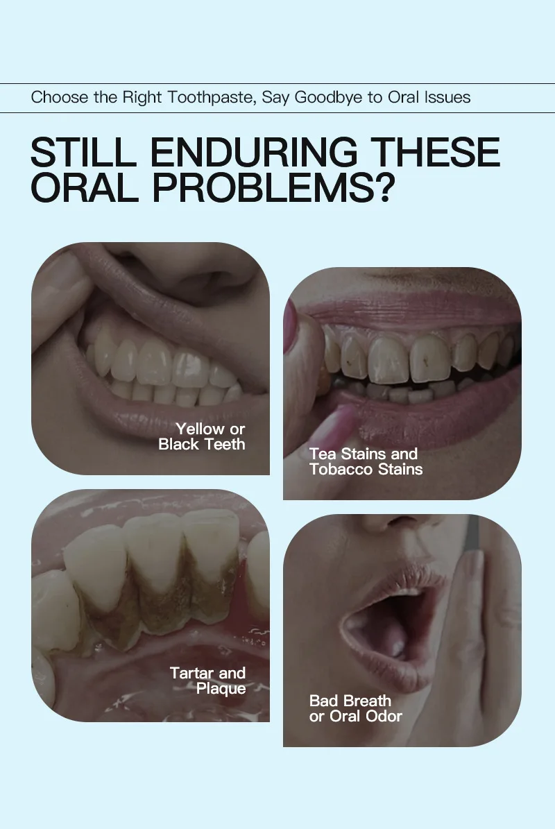 mousse de blanchiment des dents رغوة تبييض أسنان