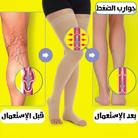 🦵 جوارب الضغط الطبية الطويلة (حتى للفخذ) 🩸 لعلاج الدوالي وآلام الساقين 🩹