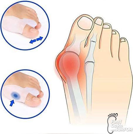 مصحح القدم السيليكوني - Séparateurs d’orteils en silicone