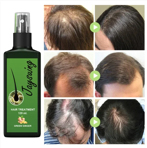 زيت جايسوينغ لعلاج تساقط الشعر 120 مل