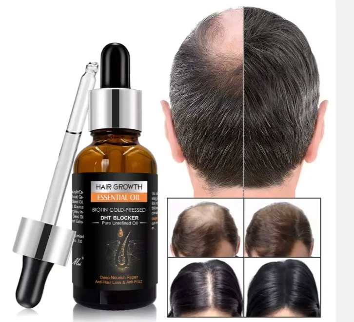 زيت نمو الشعر