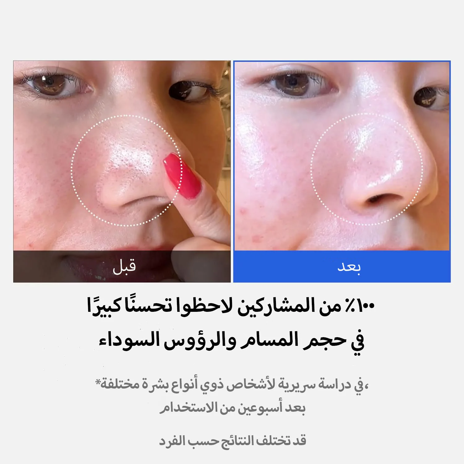 Medicube Zero Pore Pads(70pads)-ضمادات ميديكيوب زيرو لتصغير المسام وتنقية البشرة – 70 ضمادة