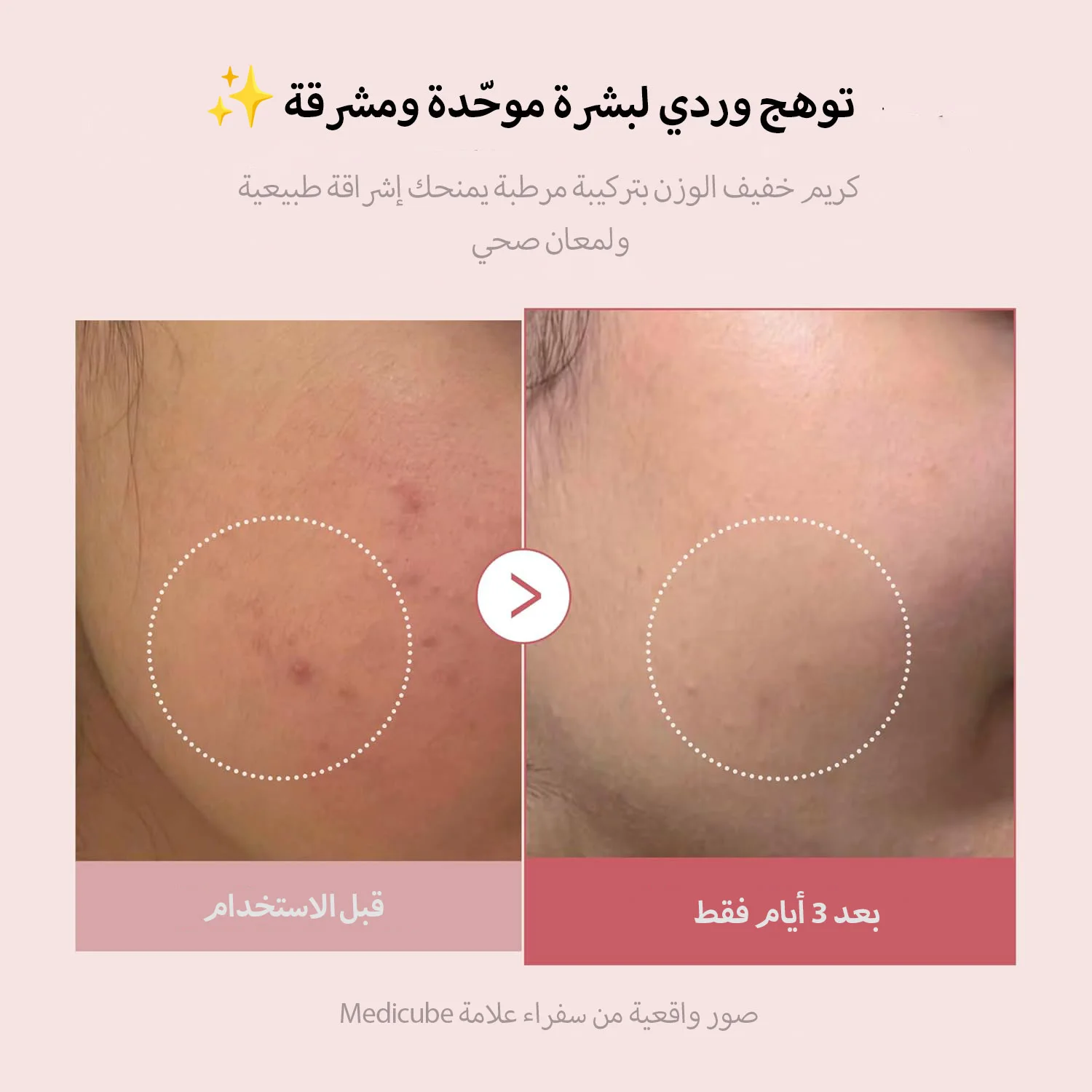 MEDICUBE PDRN PINK COLLAGEN CAPSULE CREAM 55G كريم كبسولات الكولاجين الوردي من ميديكيوب بي دي آر إن