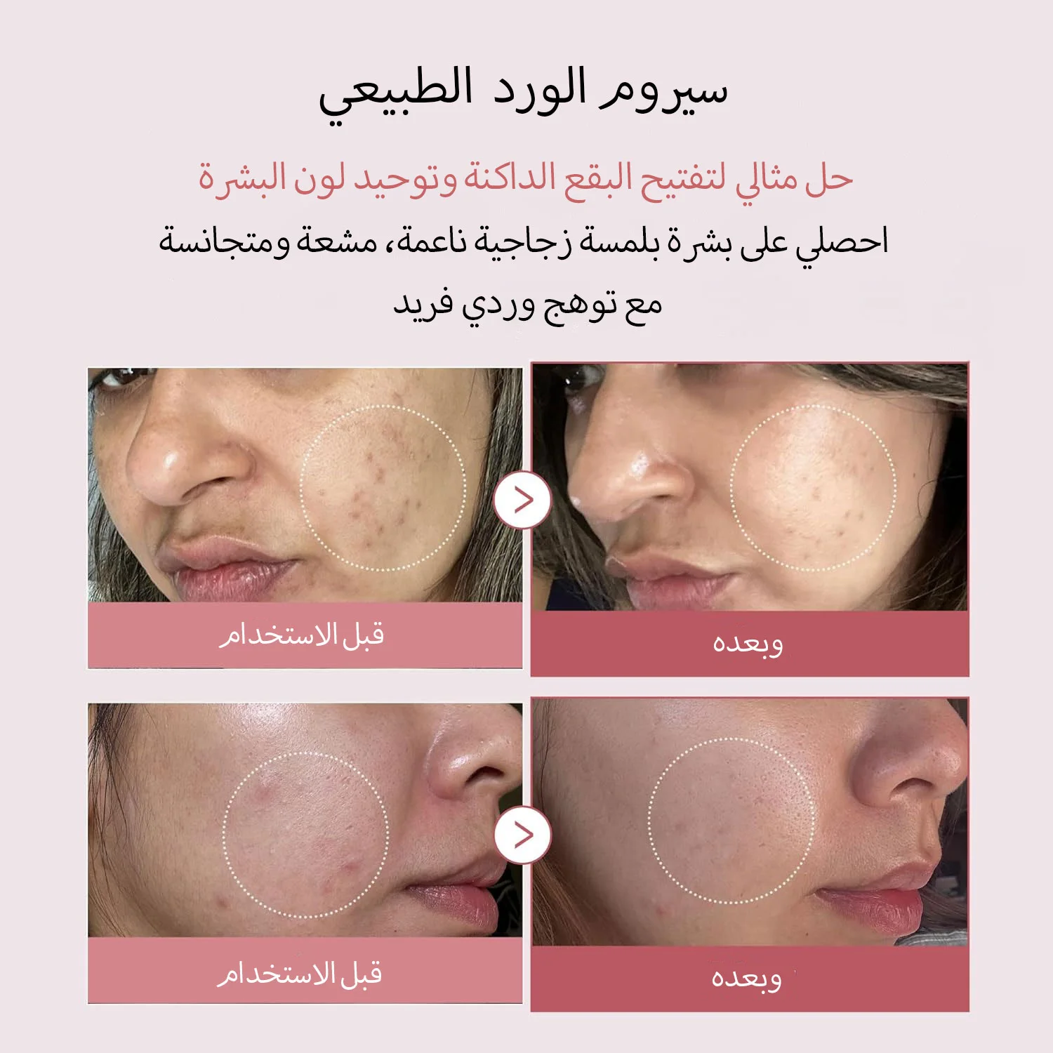 MEDICUBE PDRN PINK PEPTIDE SERUM 30ML مصل الببتيد الوردي ميديكوب PDRN