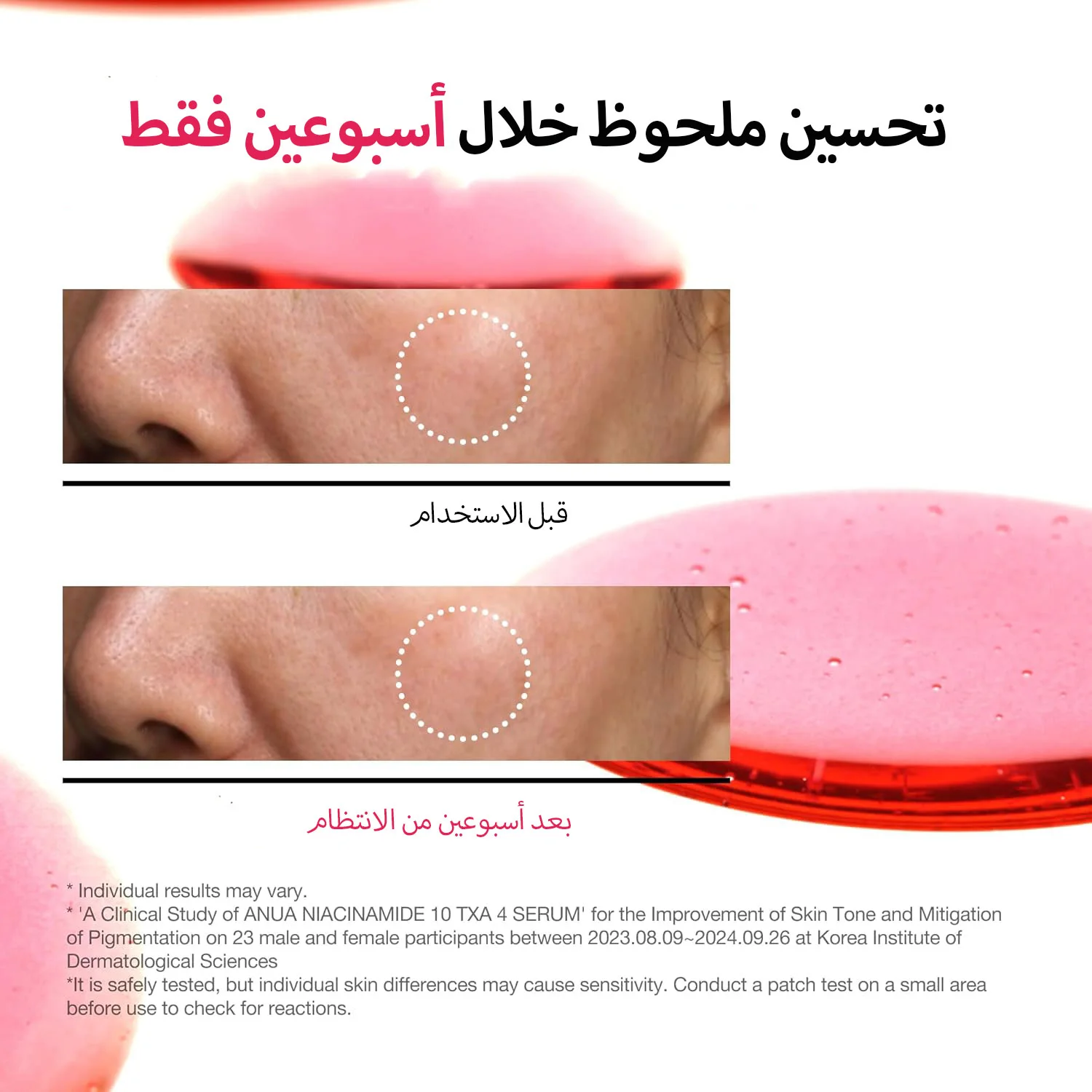 ANUA NIACINAMIDE 10% + TXA 4% DARK SPOT CORRECTING SERUM 30ML أنوا نياسيناميد 10٪ + TXA 4٪ مصل تصحيح البقع الداكنة